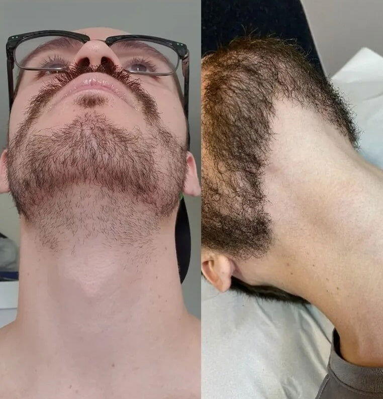 Image #1 de Loïs Joubert