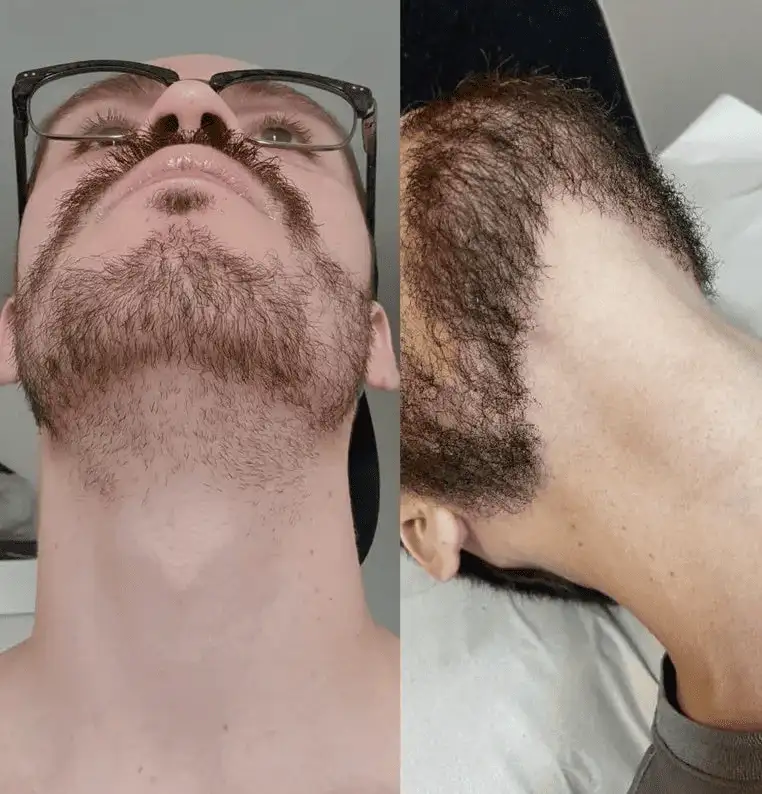 Rasoir Électrique – Smart Shaver